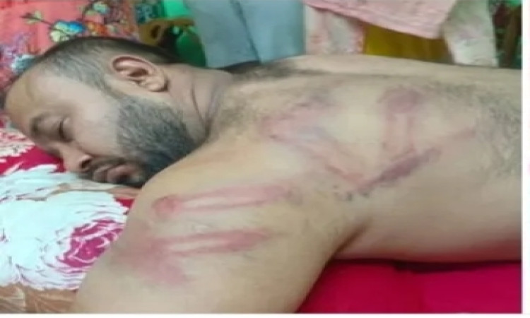 রূপগঞ্জে সাংবাদিককে পিটিয়ে মোটরসাইকেল ও টাকা লুটের অভিযোগ