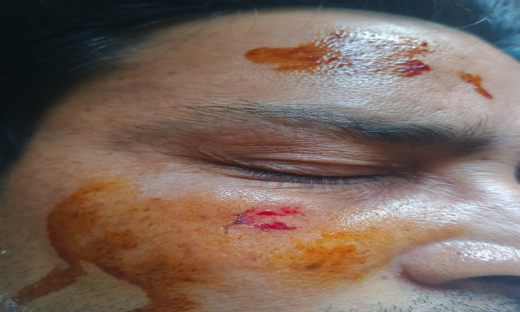 তাড়াশে সরকারি রাস্তা দখল নিয়ে সংঘর্ষ, আহত ১