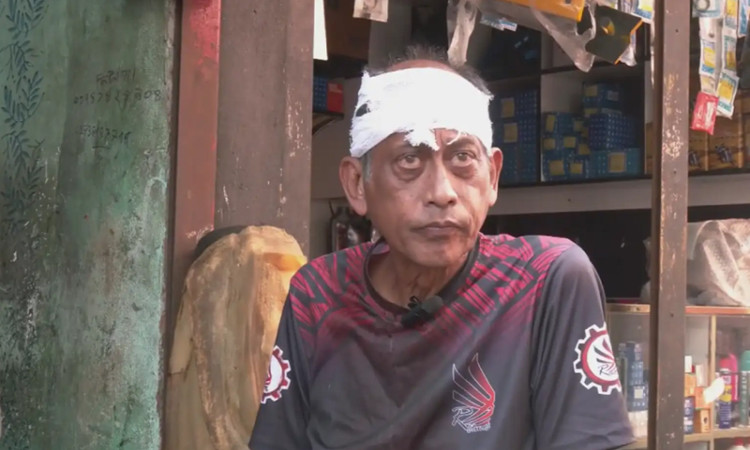 গ্যারেজ মেকানিকের ইটের আঘাতে রক্তাক্ত অভিনেতা সমু চৌধুরী